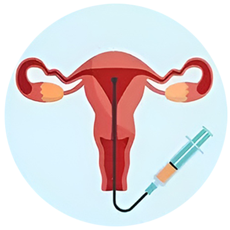 prp endometrium