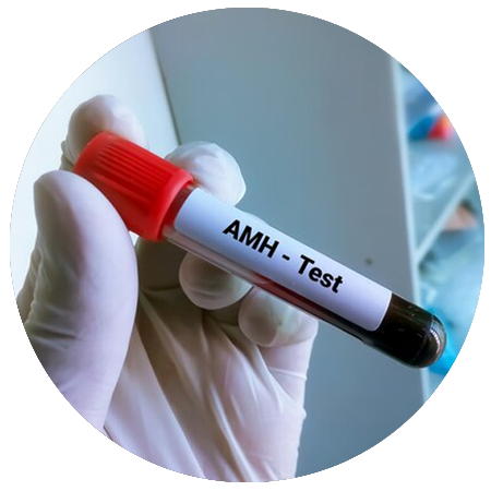 tes_amh_anandaivf